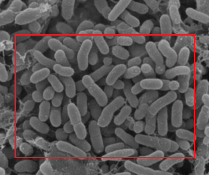 क्या एंटीबायोटिक प्रतिरोध हमारी संक्रमणों का इलाज करने की क्षमता को खतरे में डाल रहा है?
